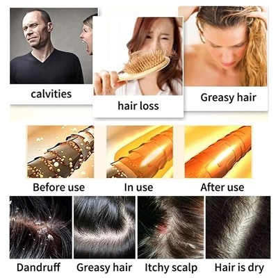 Шампунь для роста волос с розмарином, мыло против выпадения волос, натуральный органический стимулирует рост волос, против перхоти, против зуда, уход за волосами