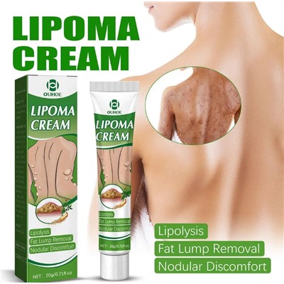 Крем Lipoma для удаления опухолей, средство для удаления отеков кожи, нодулярного дискомфорта, лечения липолиза, крем для удаления жира