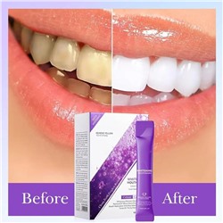 SADOER Отбеливающий ополаскиватель для полости рта V34 TEETH WHITEN, 20*10мл.